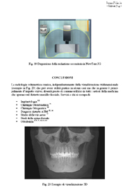 La radiologia volumetrica in odontoiatria. Applicazioni cliniche